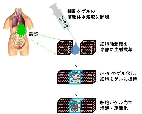 (A)インジェクタブルゲルによる細胞移植の概念図